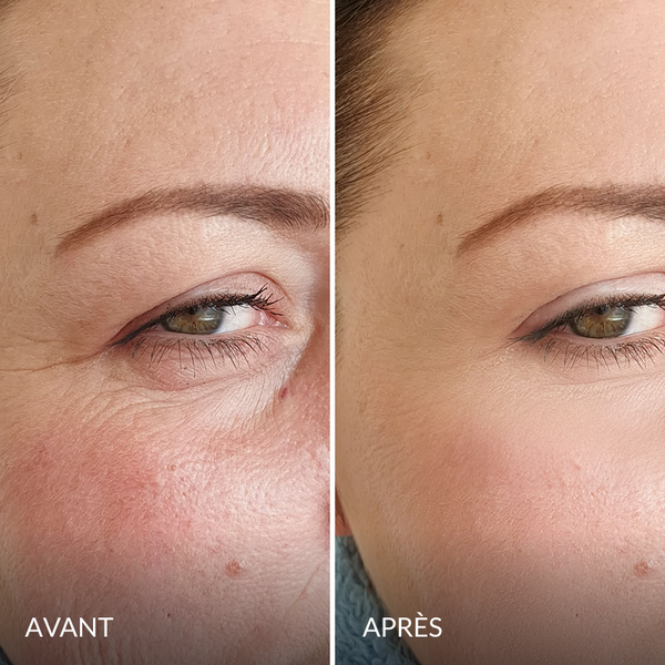 Avant / Après de Nathalie D.