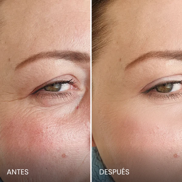 Avant / Après de Beatriz D.