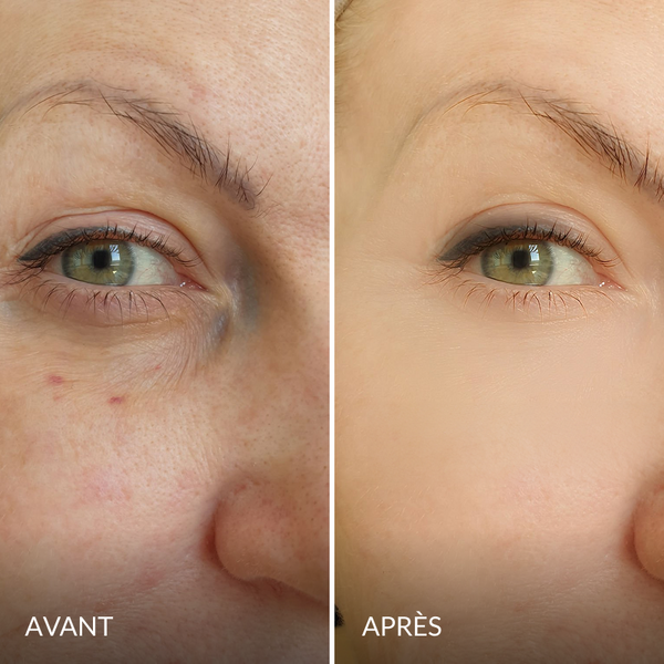 Avant / Après de Nadia F.