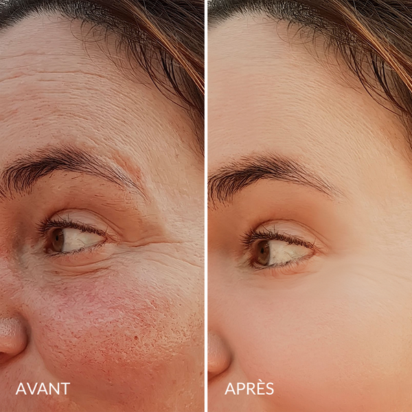Avant / Après de Noémie R.